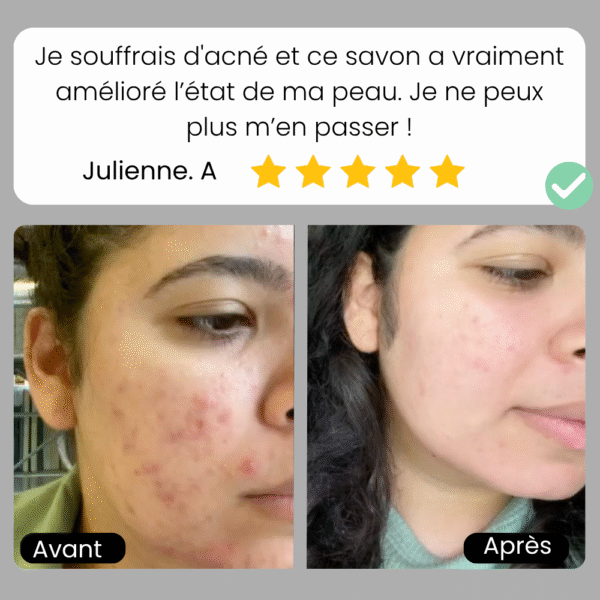 Savon Longrich au Charbon de Bambou – Image 6