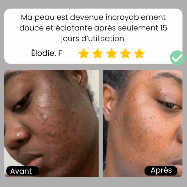 Savon Longrich au Charbon de Bambou – Image 7